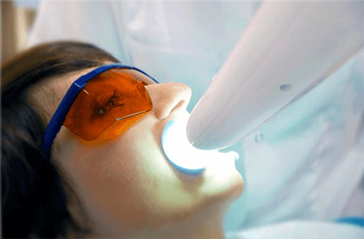Understanding the Causes of Teeth Sensitivity Halifax