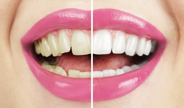 What Early Signs of Oral Cancer Should You Never Ignore Halifax?