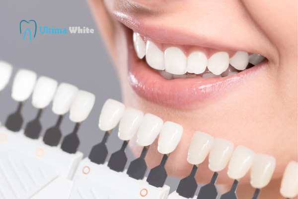 How to Maximise the Results of Your Laser Teeth Whitening Treatment Halifax