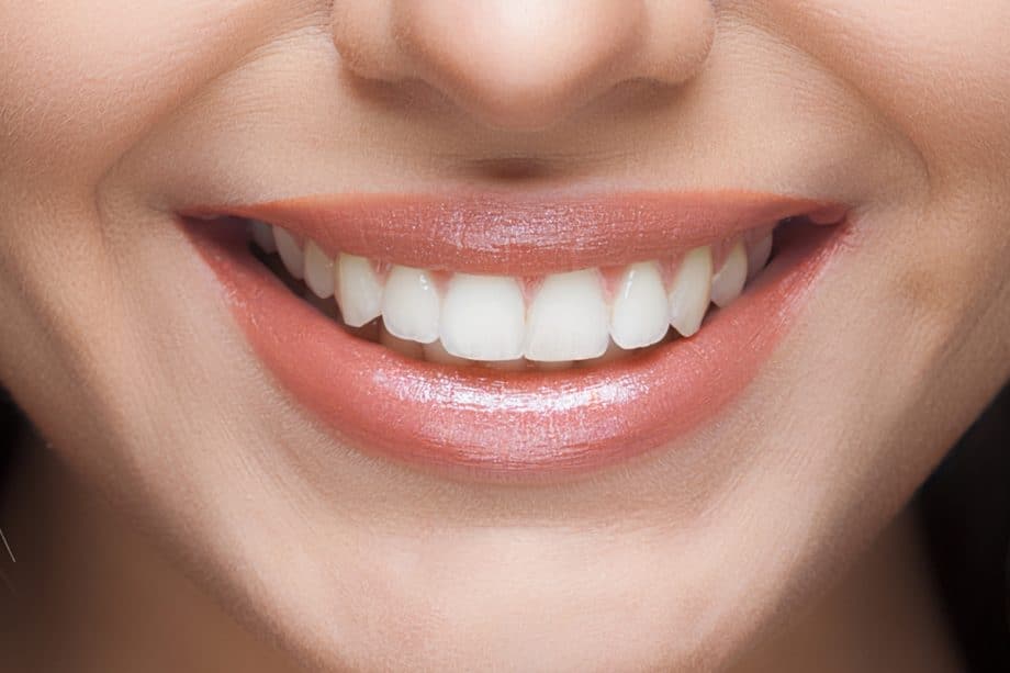 Why Do Some Teeth Whitening Results Fade Faster Than Others Halifax?