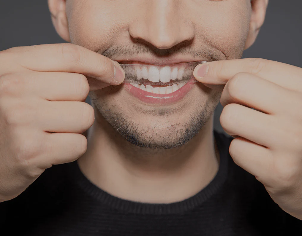 Can You Whiten Natural Teeth Without Harsh Chemicals Halifax?