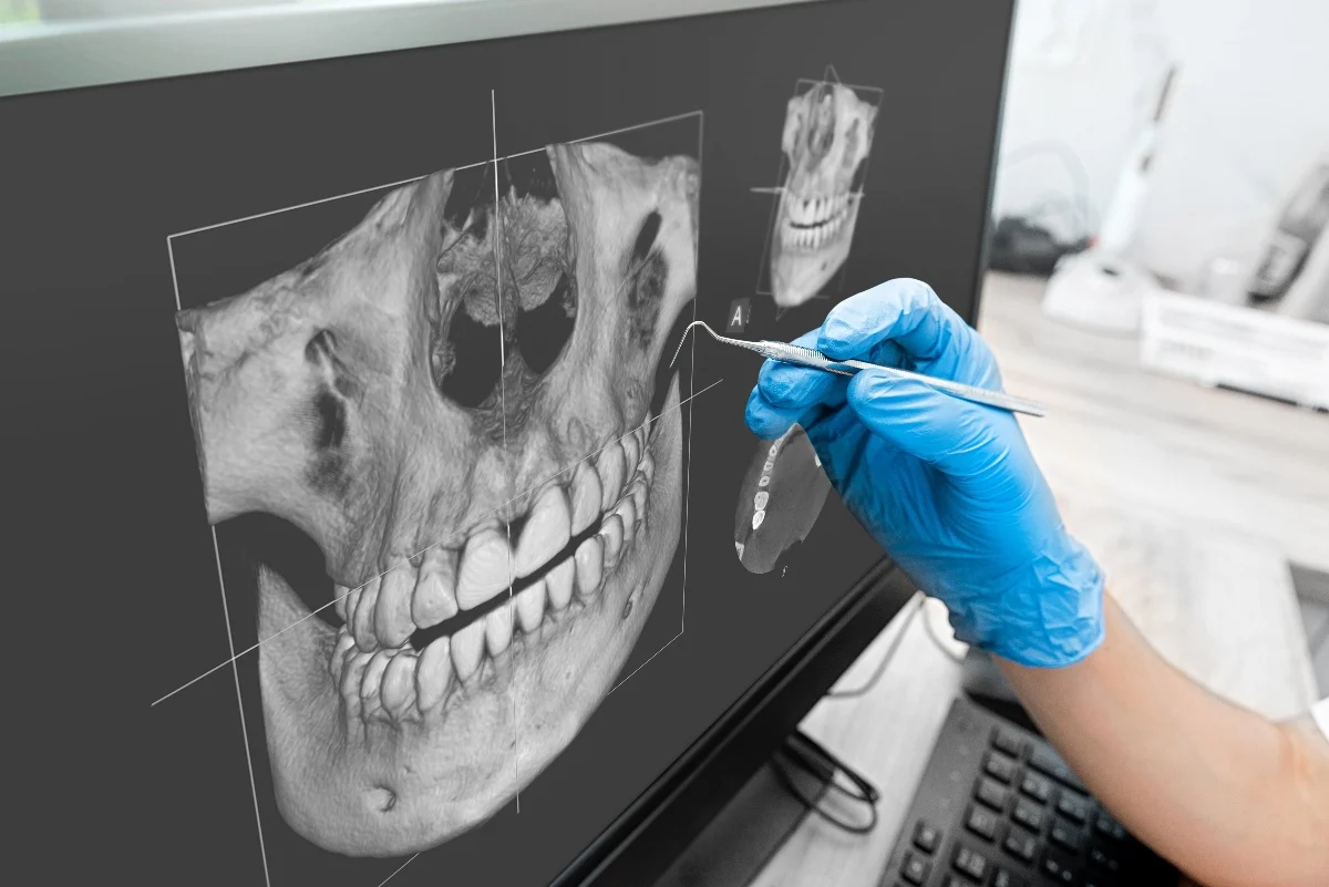 How Is AI Transforming Dental Treatment Planning Halifax?