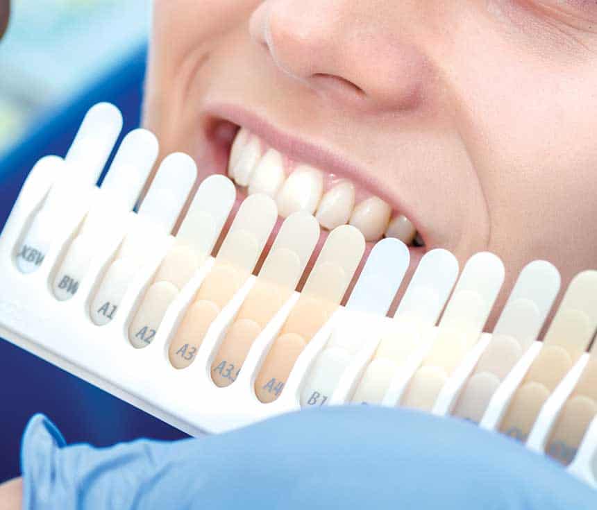 How Much Does One Laser Teeth Whitening Session Cost Halifax?