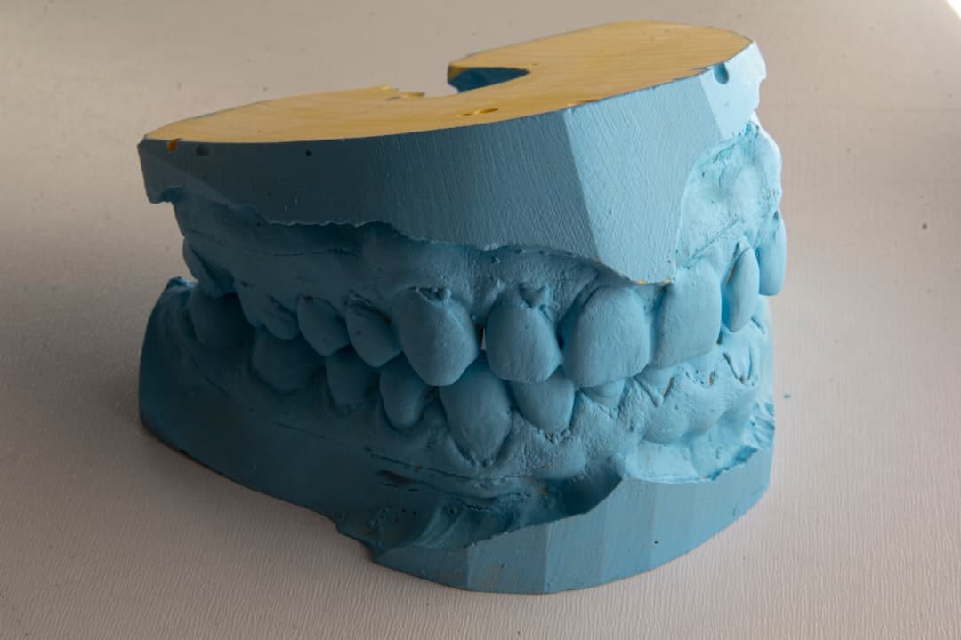 How Do Dental Implants Improve Jawbone Health and Oral Function Halifax?
