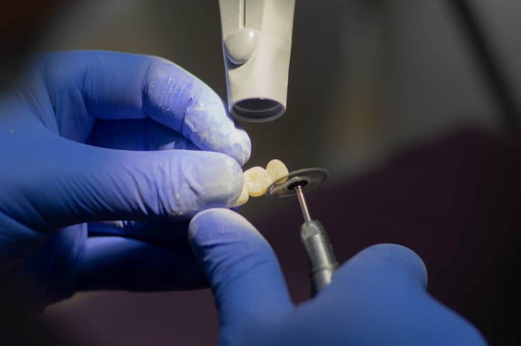 Customised Dental Solutions: Crowns, Aligners, and Implants Halifax
