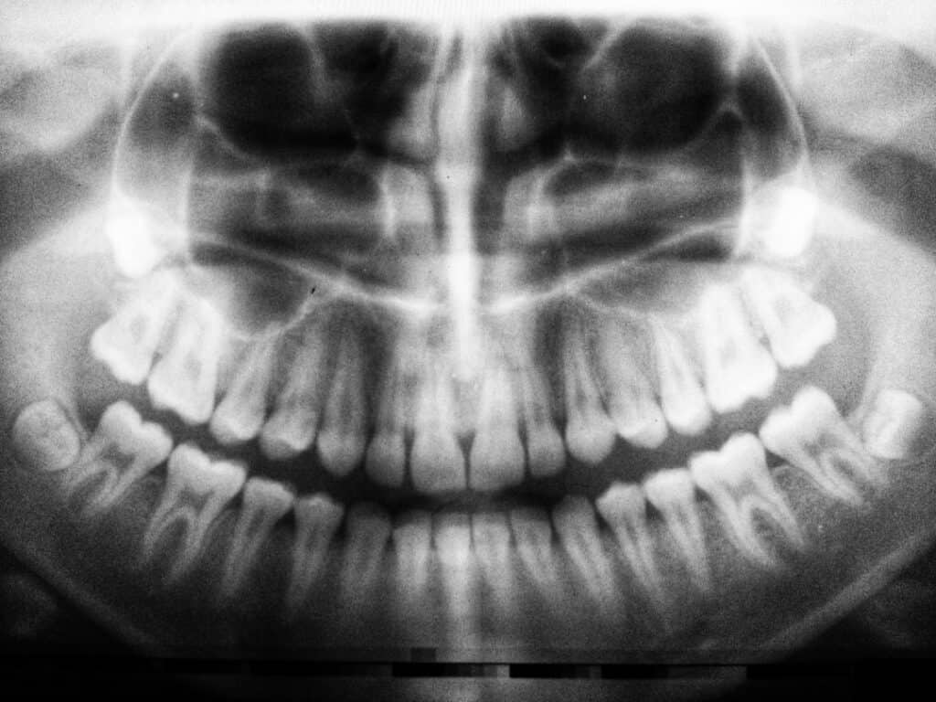 The Future of 3D Printing in Oral Healthcare Halifax