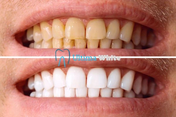 Stained Teeth and Persistent Bad Breath Halifax