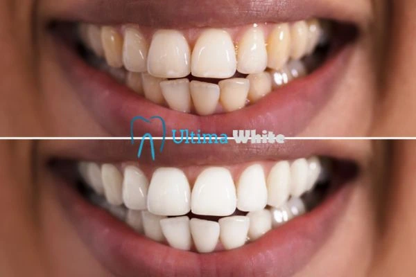 Long lasting results from Ultima White Halifax